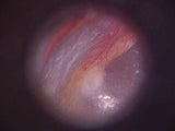 Firefly Video Otoscope