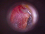 Firefly Video Otoscope
