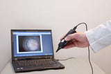 Firefly Video Otoscope