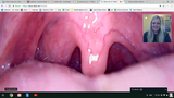 Supereyes Digital Endoscope